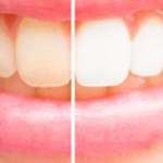 コーヒー飲んでても、輝く白い歯を保ちたい！！！【ドラッグストア】で購入出来るものから、【KUMAROMAで購入可能】なもの、【病院系】まで実践したものを一挙公開✨